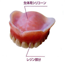 コンフォート義歯